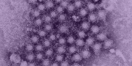 Hepatitis A virus