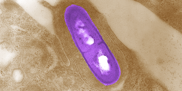 Listeria Monocytogenes