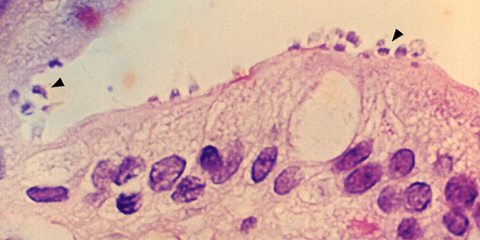 Cryptosporidum